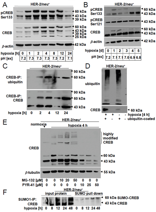 Hypoxia-mediated post-transcriptional modification and altered distribution of CREB.