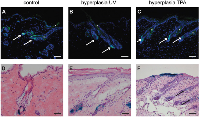Lgr5 progeny migrates out of the hair follicle into the IFE after hyperplasia induced by TPA in haired mice.