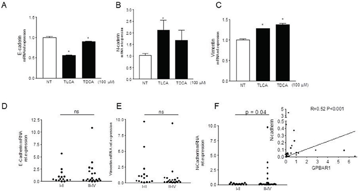 GPBAR1 agonists induce a EMT phenotype in MKN45 cells.