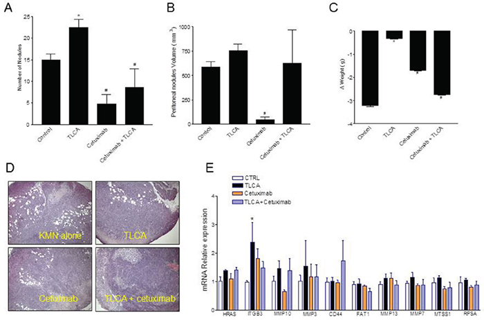 GPBAR1 activation enhances the metastatic potential of MKN45 cells.