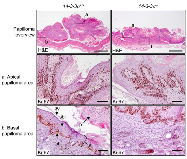 Morphology of DMBA/TPA-induced epidermal tumors in mice with varying
