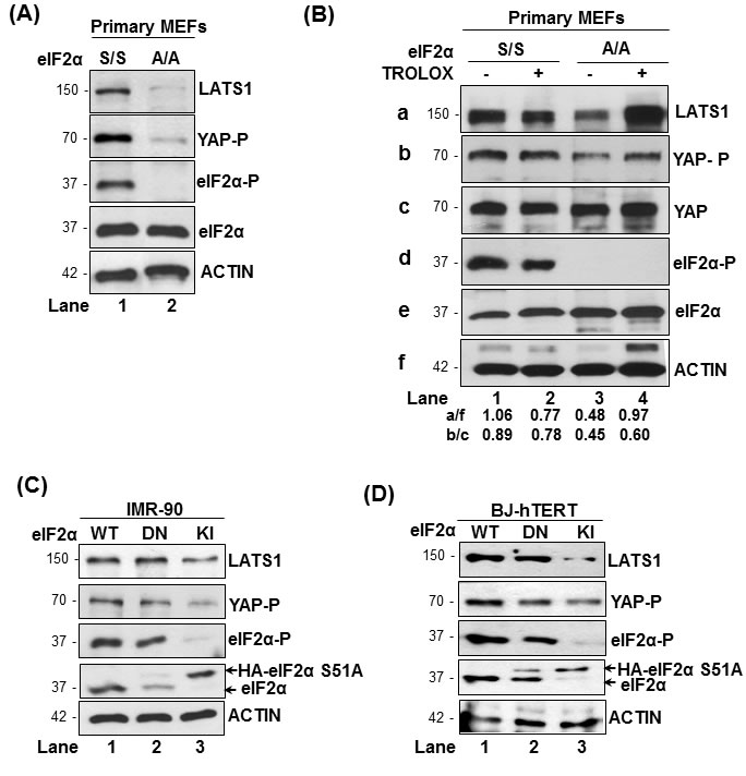 eIF2&#x3b1;P promotes LATS1 expression in mouse and human fibroblasts.