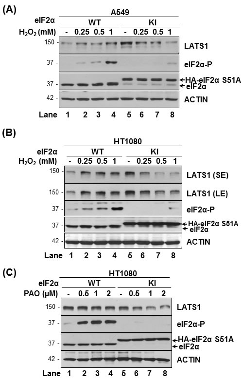 eIF2&#x3b1;P facilitates LATS1 expression in tumor cells under oxidative stress.