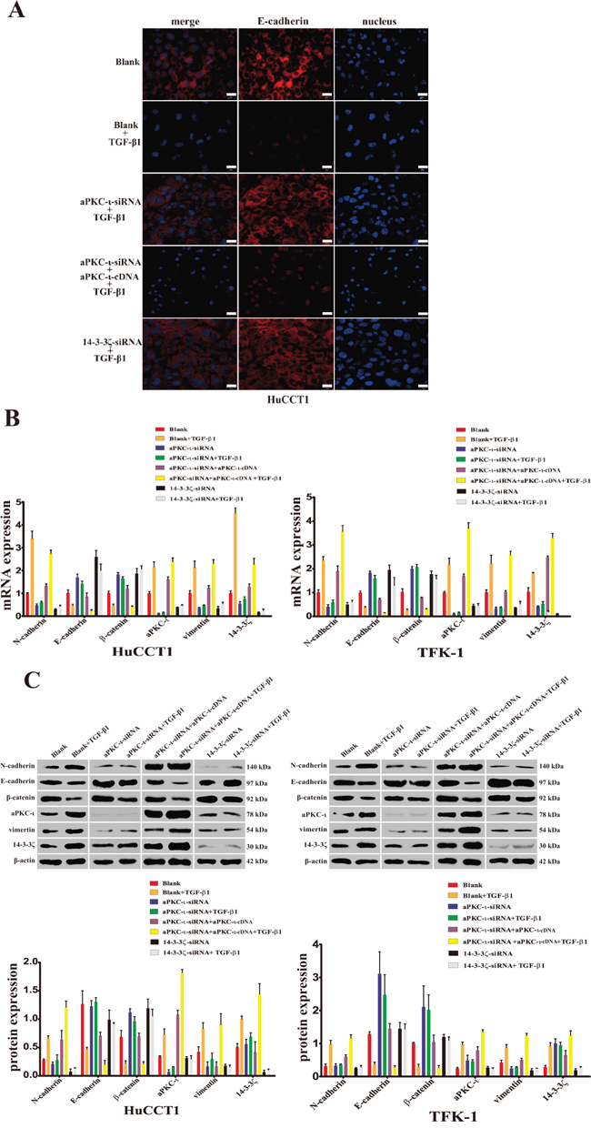 Reduced expression of aPKC-&#x03B9; and 14-3-3&#x03B6; inhibits the TGF-&#x03B2;1-induced EMT in CCA cells in vitro.