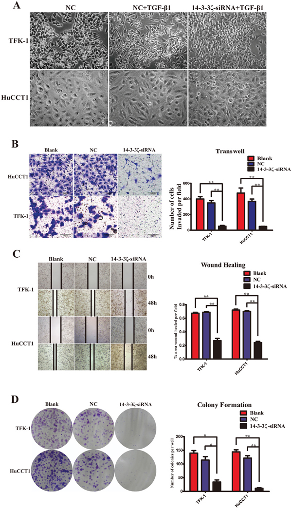 Inhibition of 14-3-3&#x03B6; repress EMT, invasion, migration and proliferation of CCA cells in vitro.