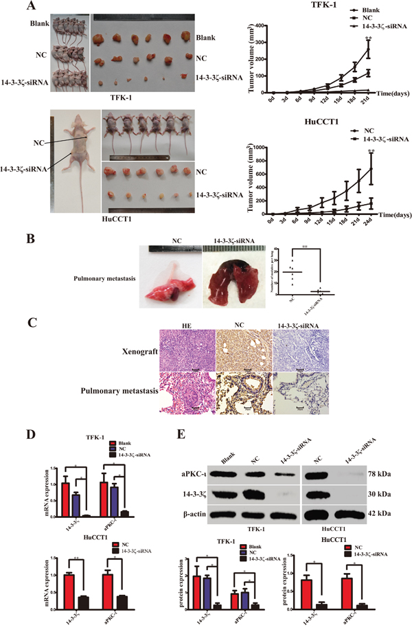 Silence of 14-3-3&#x03B6; suppress CCA cell proliferation, invasion and metastasis in vivo.