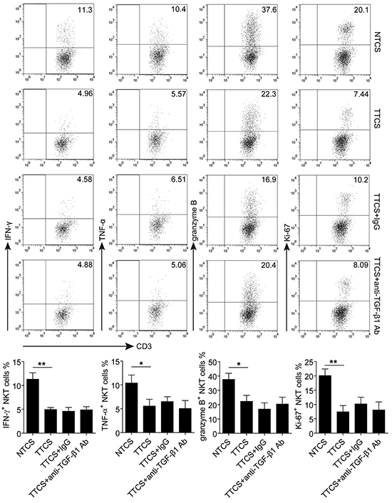 The functional impairment of CD3&#x002B;CD56&#x002B; NKT-like cells induced by soluble factor(s) from tumor tissue culture supernatant.