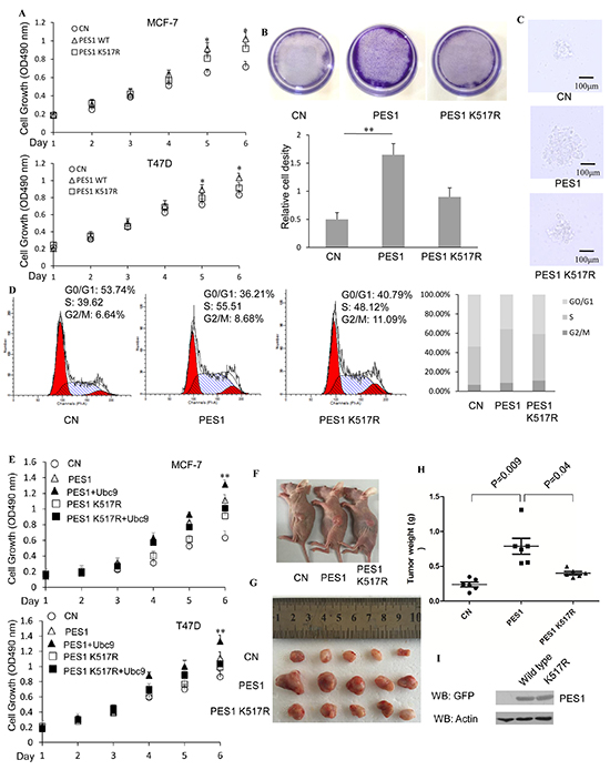 SUMOylation of PES1 promotes the growth of breast cancer cell lines.