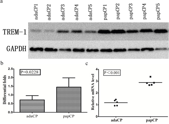 TREM-1 expression pattern in aCP and pCP tissues.
