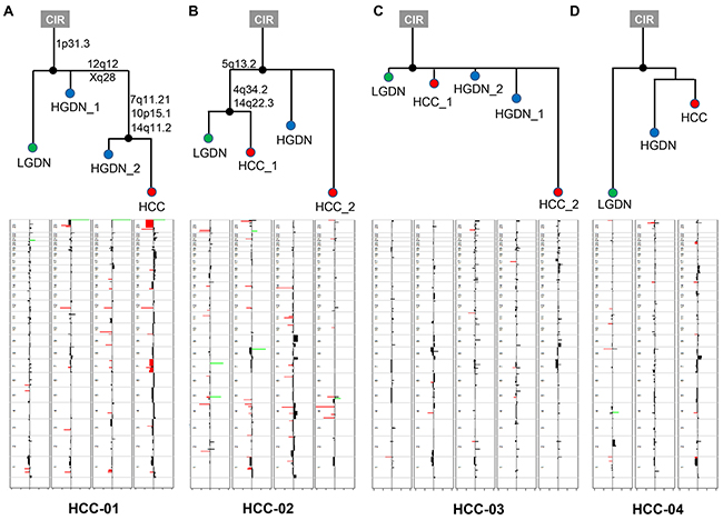 The phylogenetic trees inferred from copy number profiles of four HCC patients.