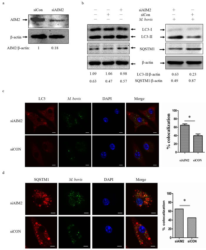 The AIM2 inflammasome down-regulates M.bovis-induced autophagy.
