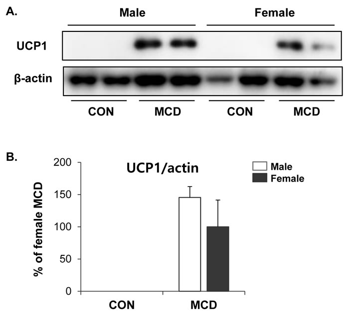 No difference in effects of MCD diet on browning of inguinal white adipose tissue in female and male.