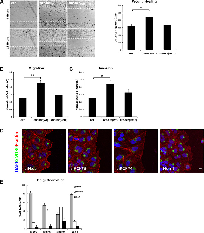 Overexpression of RCP promotes cell motility.