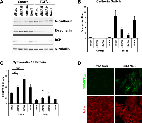 RCP knockdown disrupts the cadherin switch during EMT.