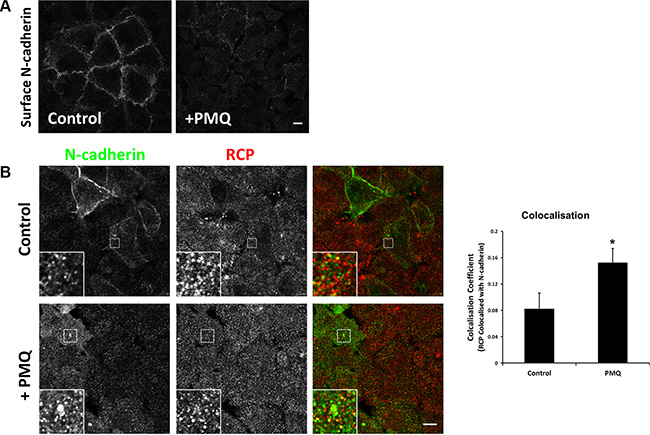 N-cadherin is continuously internalised and recycled in A549 cells.