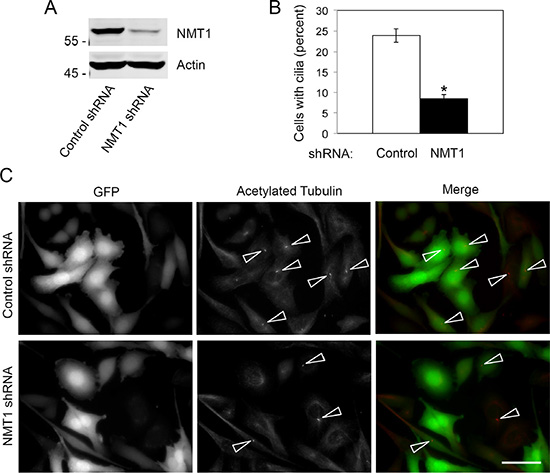 NMT1 is necessary for cilia formation in Pan02 cells.