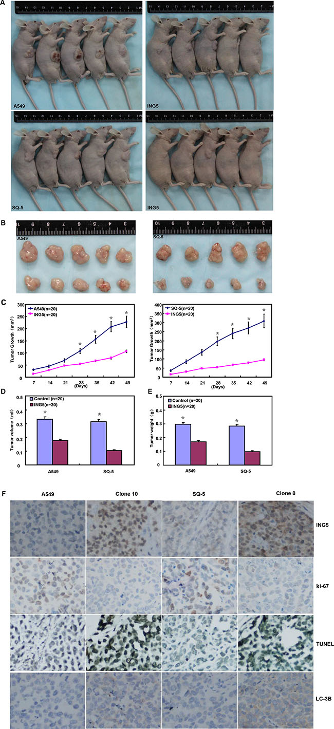 ING5 suppresses the growth of lung cancer cells in the nude mice.
