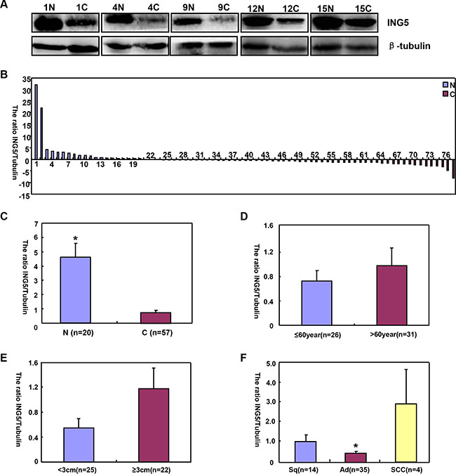 The correlation of ING5 protein expression with clinicopathological features of lung cancers.