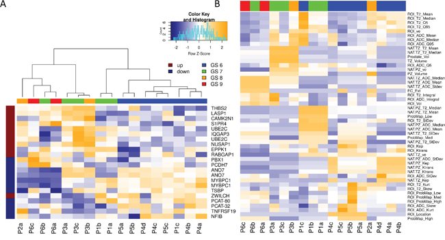 Hierarchical clustering of Genomic and Radiomic features and patient samples.