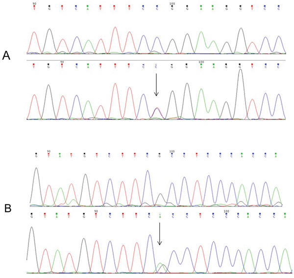 Partial sequence of exon 10 and exon 28 in the DUOX2 from WT(top) and mutational individuals (below).