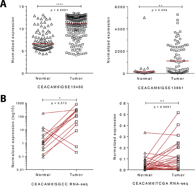 Gene expression analysis of gastric cancers show an enrichment for CEACAM6.