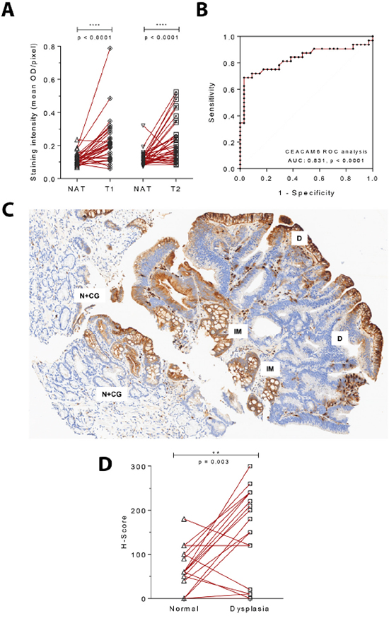 CEACAM6 is upregulated in both early gastric cancers and dysplastic lesions of the stomach.