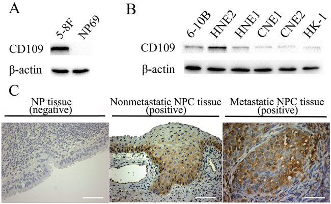 Expression of CD109 in different cell lines and immunostaining of CD109 in clinical NPC and NP tissues.