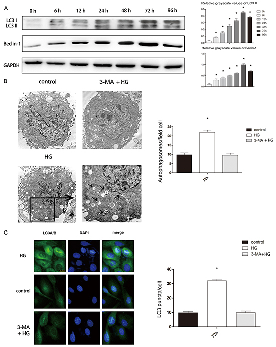 High glucose treatment of hFOB 1.19 cells induced autophagy, which was blocked by 3-MA.