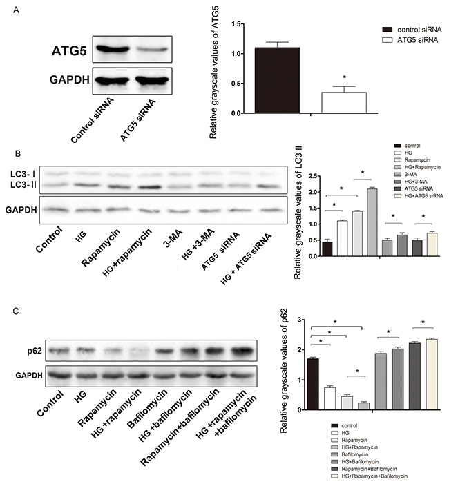 Effect of HG on the expression of the autophagy-related proteinsATG5, LC3, and p62 in hFOB 1.19 cells.