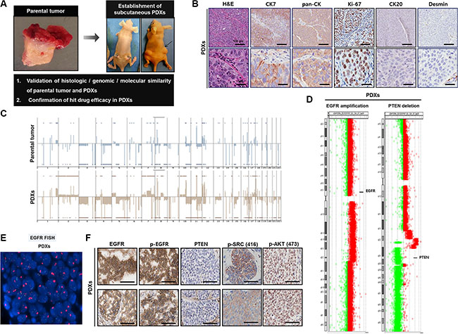 Establishment of patient-derived xenograft (PDX) models in 138T muscle-invasive bladder cancer (MIBC) and validation of the genetic, molecular, and histologic similarity between parental and PDX tumors.