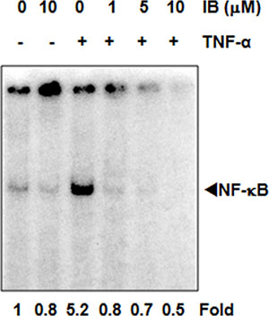 Imipramine blue (IB) blocks NF-