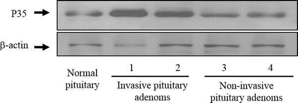 Representative Western blots of p35 in invasive and noninvasive prolactin pituitary adenomas.