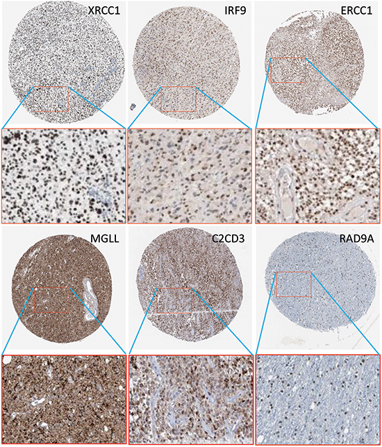 Protein expressions of IRF9, XRCC1, ERCCC1, MGLL, C2CD3, and RAD9A in corresponding antibody-stained images from Human Protein Atlas.