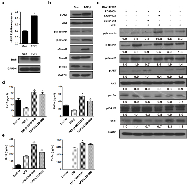 TGF-&#x03B2; regulates SNAIL expression via activation of PI3K/AKT and Smad2/3 signaling pathways in THP-1 macrophages.