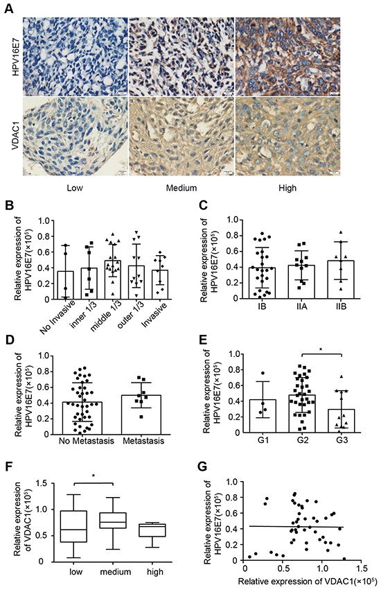 HPV16 E7 expression was not related to clinicopathologic features or VDAC1 expression in cervical cancer.