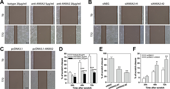 Modulation of ANXA2 activity or expression levels impacts primary GBM cell migration.