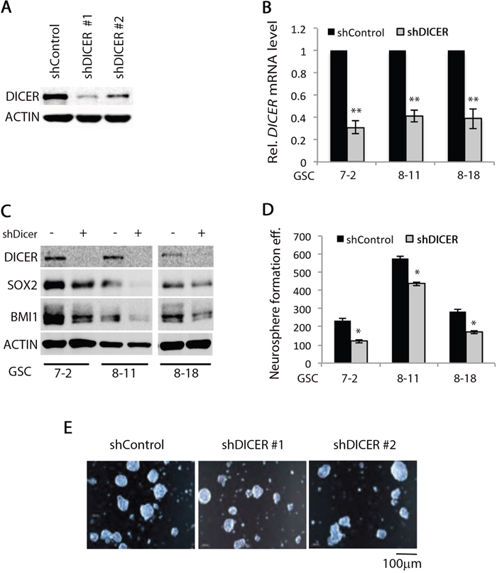 DICER1 knockdown alters GSC characteristics.