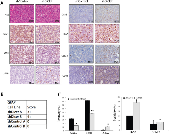 Immunohistochemical analysis of stemness, proliferation, and differentiation marker genes in shDICER and shControl tumors.