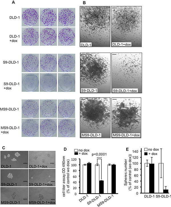 SOX9 decreases the clonal capacity of DLD-1 cells, induces a cell-cell contact inhibition and prevents colonospheres formation.