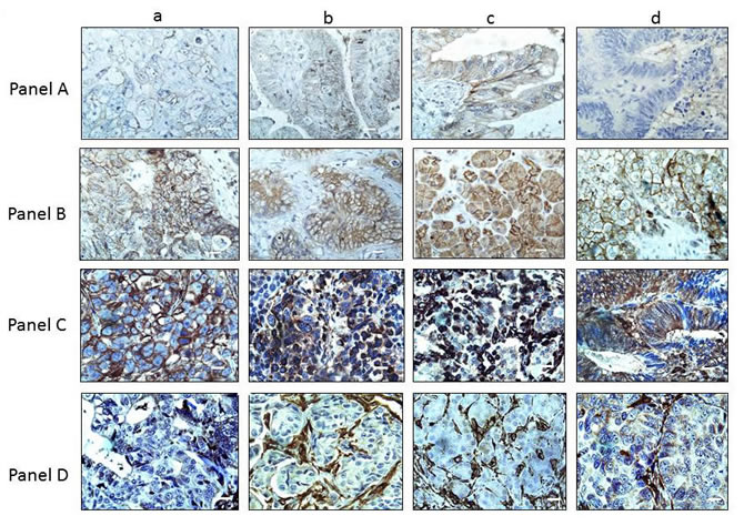 BRG1 Loss Drives E-cadherin Downregulation and Vimentin Upregulation Panels A.