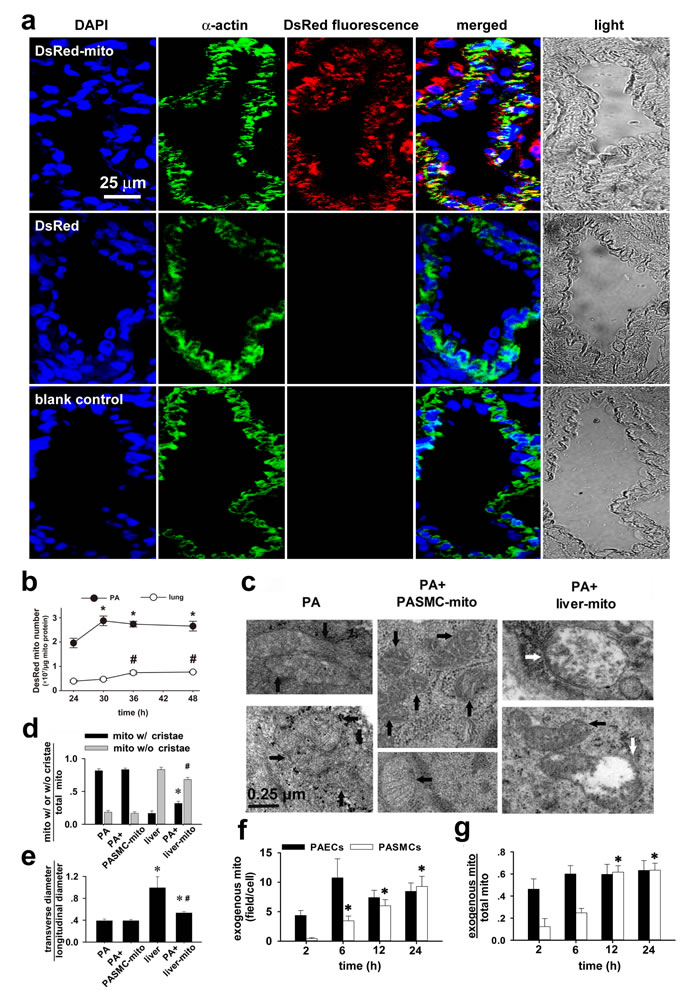 Transplantation of mitochondria into pulmonary arteries by intravenous administration.