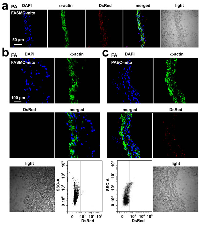 Transplantation of small mitochondria into femoral arteries by intravenous administration.