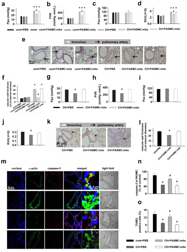 Therapeutic and preventive effects of transplanted mitochondria via intravenous injection on chronic hypoxia-induced pulmonary hypertension in rats.