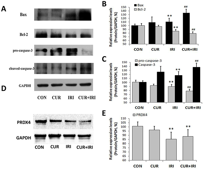 Effects of irinotecan and/or curcumin treatment on apoptosis and oxidative stress in tumor.