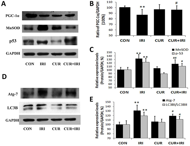 Effects of irinotecan and/or curcumin treatment on mitochondrial biogenesis and autophagy activation.