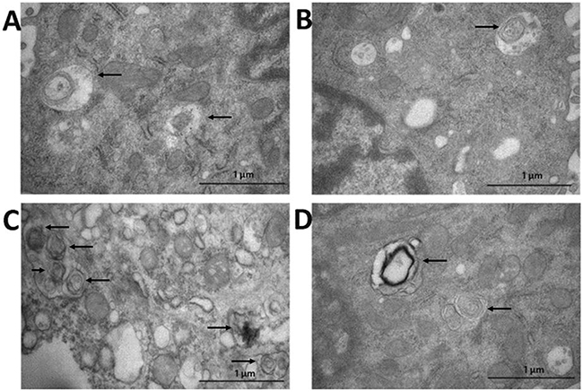 Detection of autophagosome in intestinal tissue by transmission electron microscope (arrows).
