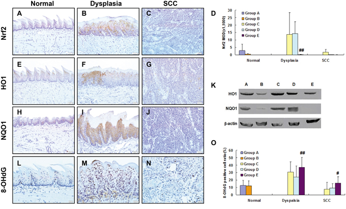 Expression of NRF2, HO1, NQO1 and 8OHdG in 4NQO/SFN-treated mouse tongue: Normal epithelium (A, E, H, L), dysplasia (B, F, I, M) and SCC (C, G, J, N).