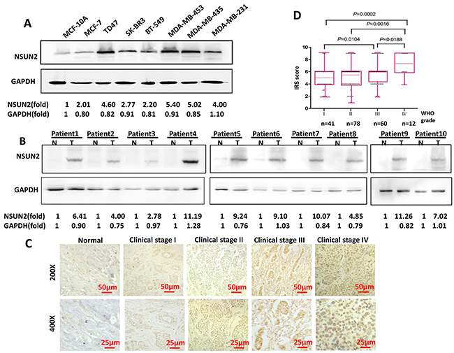 NSUN2 expression in breast cancer cells and tissues.