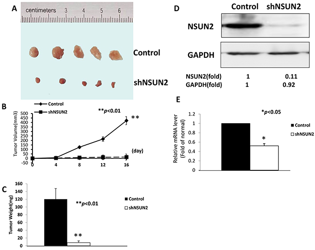 NSUN2 overexpression contributes to the progression of breast cancer in vivo.