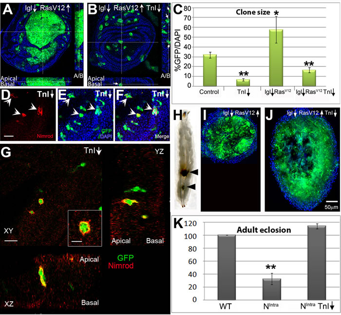 TnI down-regulation triggers cell death and suppresses tumor overgrowth.